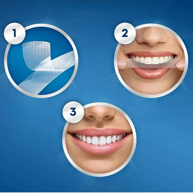 Crest 3D Whitestrips Glamorous Effects – Teeth Whitening